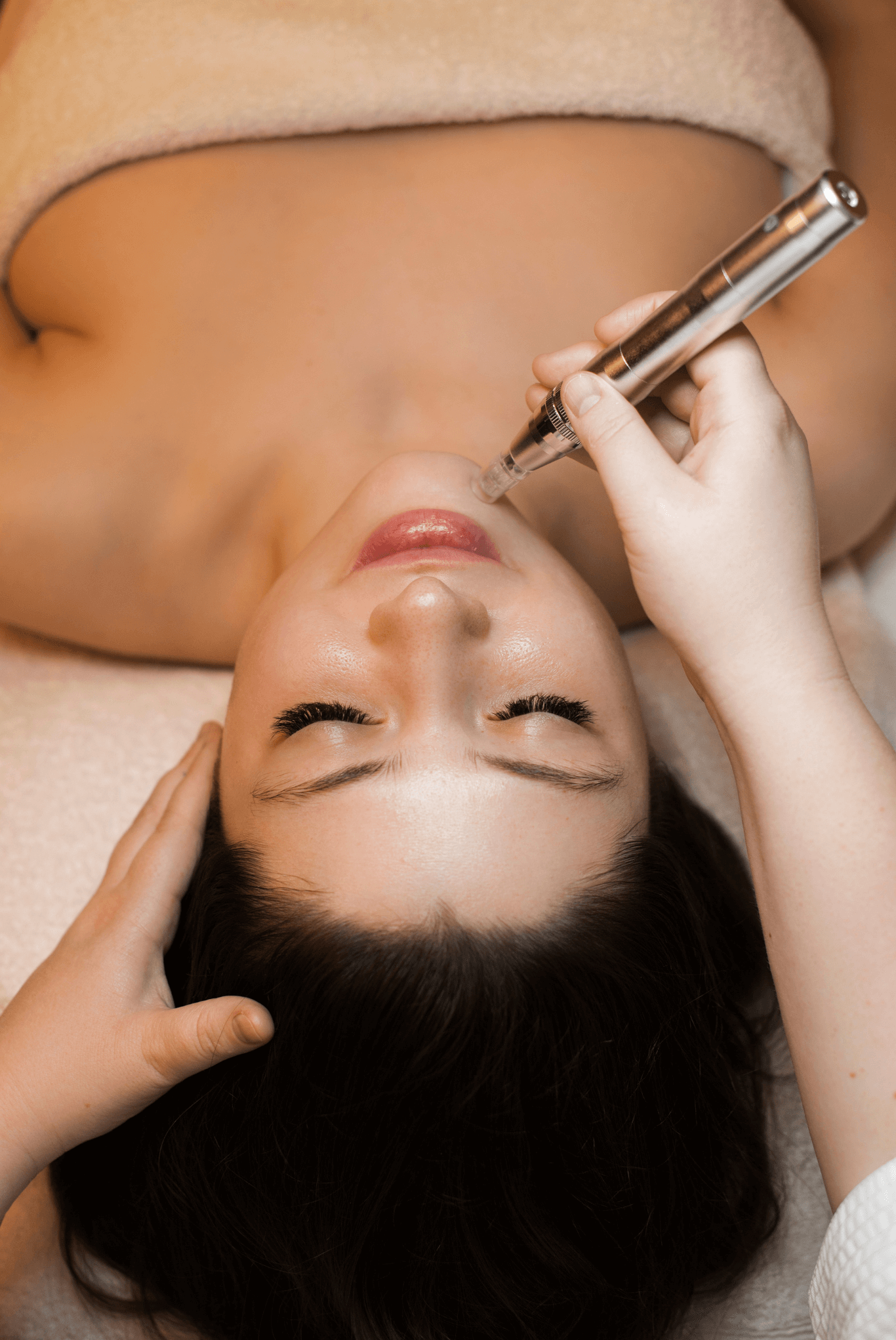 Model bei der Microneedling Behandlung