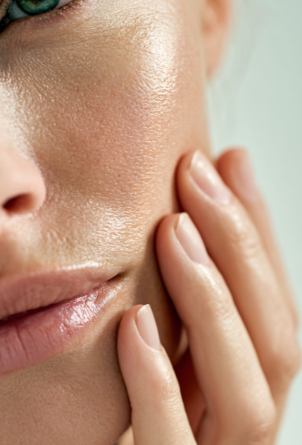 Microneedling Behandlung in Münster zur Verfeinerung großer Poren