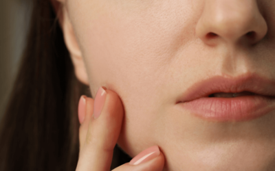 Winterhaut adé – So wird deine Haut fit für den Frühling